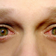 Illustration for article titled A Lady Grew Bones in Her Eyelids Because of a Dangerous New Surgery